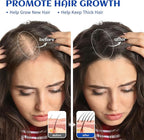 HIQILI Rosemary Oil for Hair Growth, Skin, Scalp, 100% Pure Natural, Add to Shampoo & Conditioner - 0.33 Fl Oz/10 ML